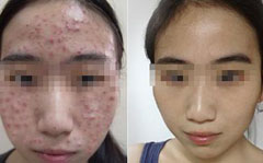 �Ϸʻ���Ƥ����ҽԺ