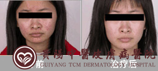 �Ϸʻ���Ƥ����ҽԺ