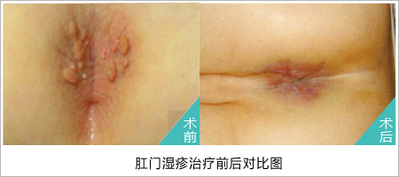 ����ʪ��